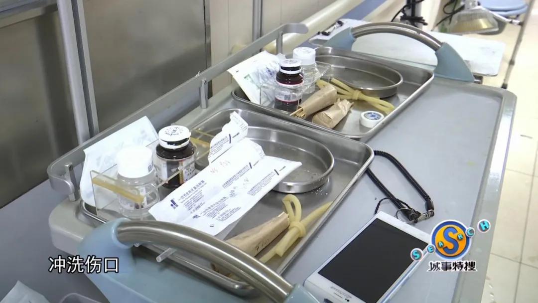 男子被钳子夹住致命部位,男子被咬一口全身器官衰竭