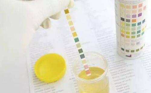 尿里有蛋白一个隐血一个是肾炎吗,仅尿蛋白1+能判断是肾炎吗