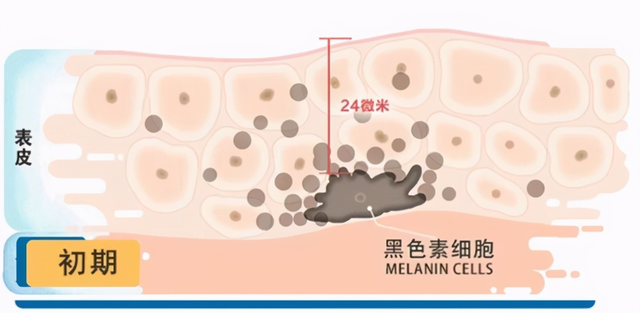 面膜敷多长时间才是正确的,面膜多久敷一次对皮肤好