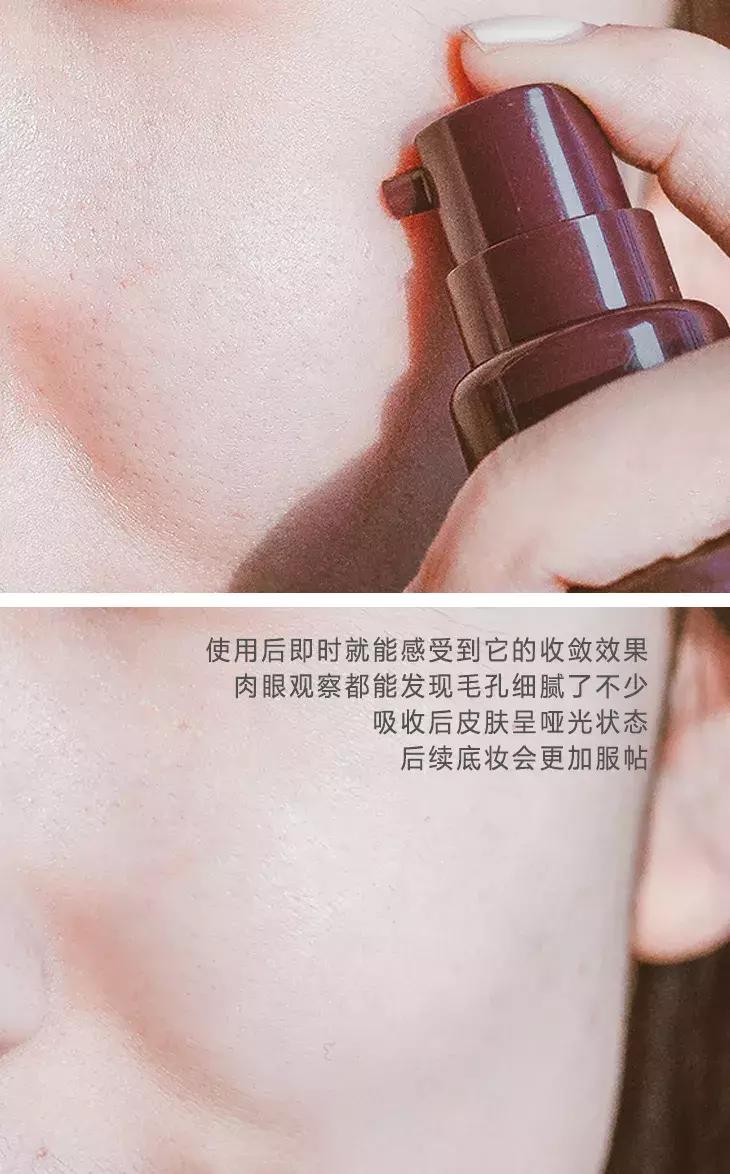 吸黑头神器去粉刺角质收缩毛孔,皮肤清洁收缩毛孔黑头角质