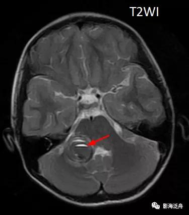 棰呰剳纾佸叡鎸痙wi搴忓垪,棰呰剳dwi搴忓垪鏈鏄庢樉寮傚父