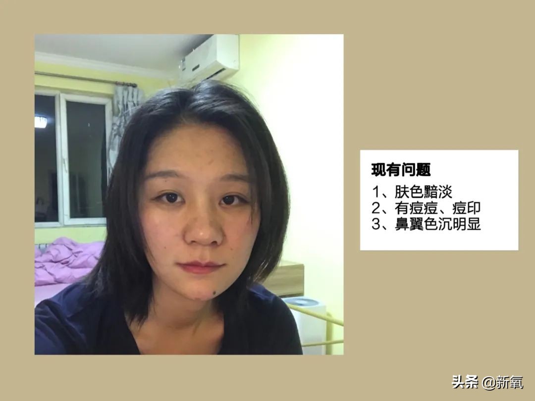 村姑整成鞠婧祎的鼻子变天使,鞠婧祎的鼻子整过吗