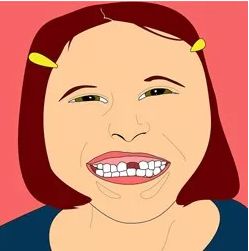 假牙的种类及价格详细介绍图片,目前国内最好的假牙是多少钱