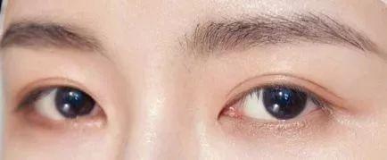 超全眼型大解析!金鱼眼,死鱼眼,下垂眼终于有救了!