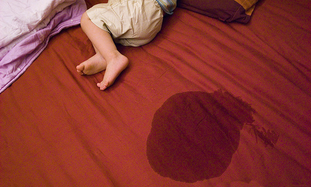 6岁孩子还会尿床该不该打,孩子多大尿床要如何干预