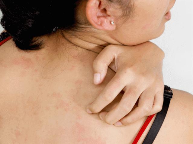 皮肤科医生都推荐的硫磺液体香皂，李佳琦5分钟卖了14406套