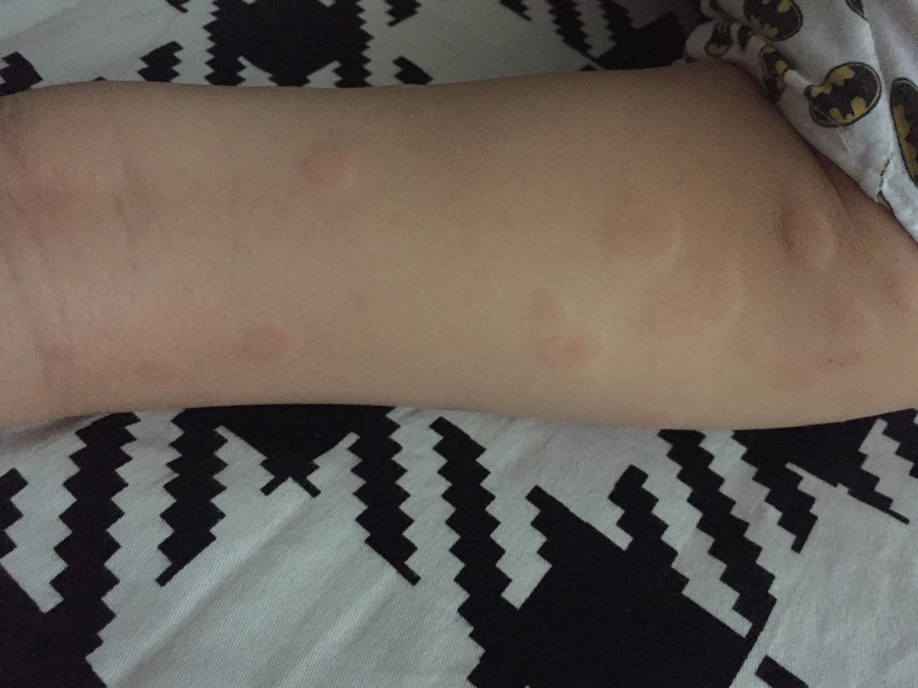 花生虽好六种人不能吃,花生千万不要这样吃