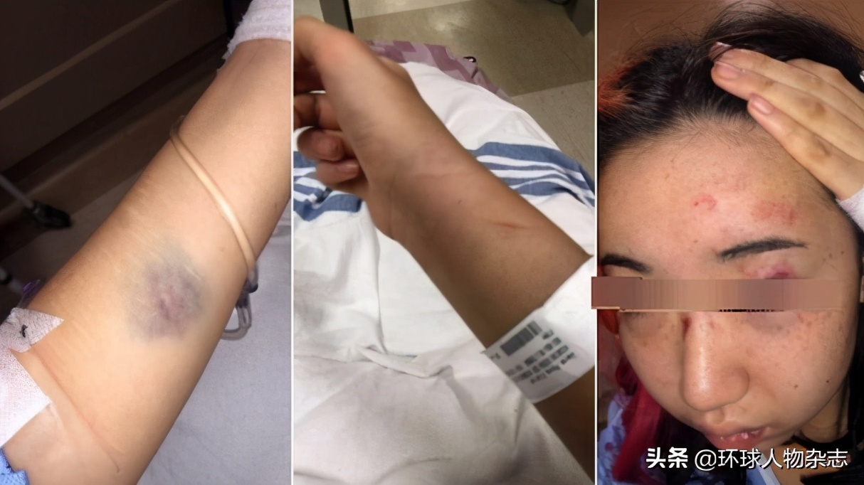 孟晚舟案真相曝光,孟晚舟事件曝光