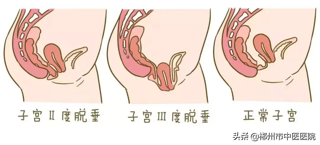 咳嗽时也打喷嚏怎么回事,上厕所打喷嚏咳嗽