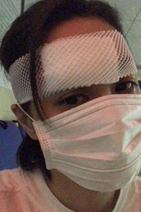 阿娇受伤的真实原因,如何看待阿娇受伤了