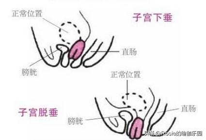 从开始怀孕到产后的心酸,有人从怀孕一个月就开始耻骨痛