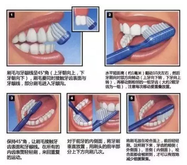 预防牙周病有效的方法,预防牙周病的十种方法