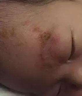 外食族春游|学霸妈妈的湿疹对策超实用辅食装备推荐