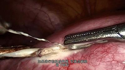 网飞利润,网飞靠什么盈利