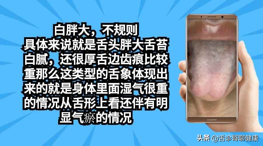 舌诊歌舌象分析及感悟,舌诊哥肝郁脾虚