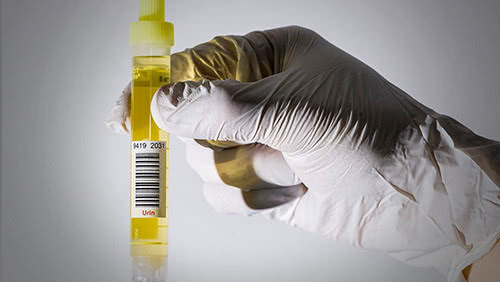 人体八大系统之“泌尿系统疾病的防与治”