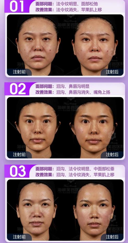 乔雅登认证注射医生,乔雅登注射专家