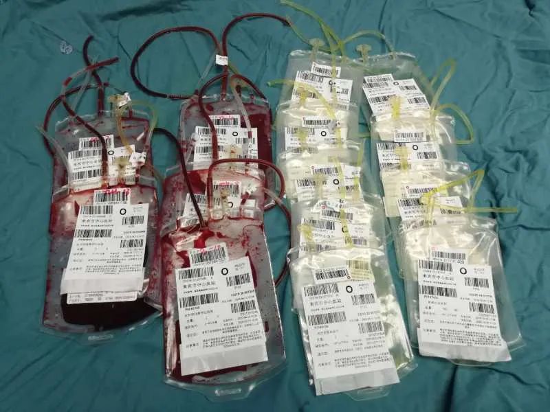 产妇大出血事件最新消息,生完孩子产妇大出血死亡