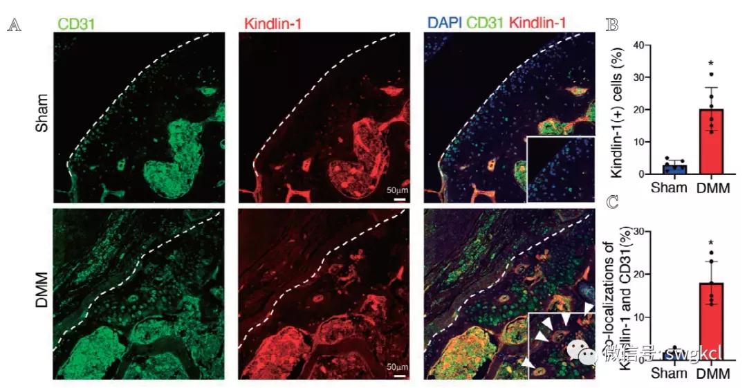 粘着斑相关蛋白Kindlin-1在血管内皮细胞的表达及功能研究