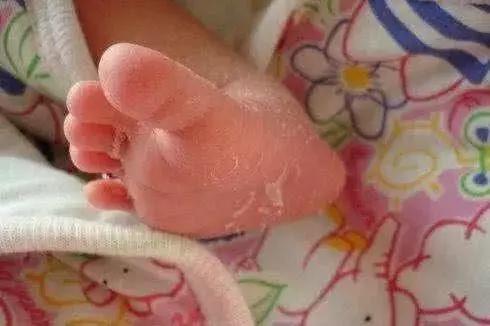 勃起、大姨妈，宝宝一出生就有这些羞羞的动作，正常吗？