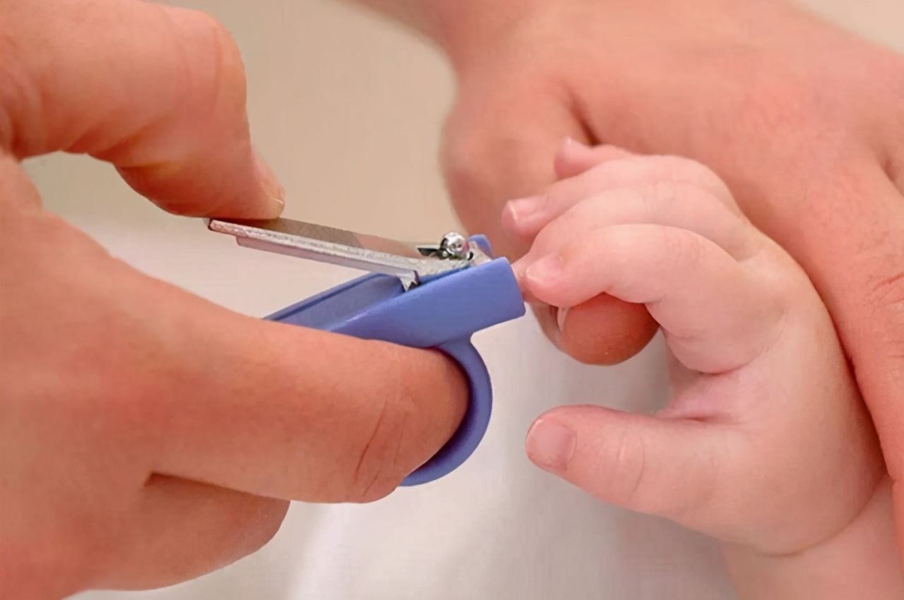 宝宝总是把自己挠破,宝宝老是挠破怎么办