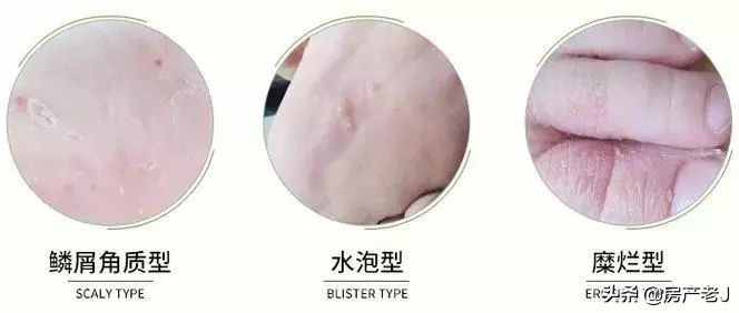 鞋子很臭怎么刷才能不让它臭呢,5分钟去除鞋子臭味