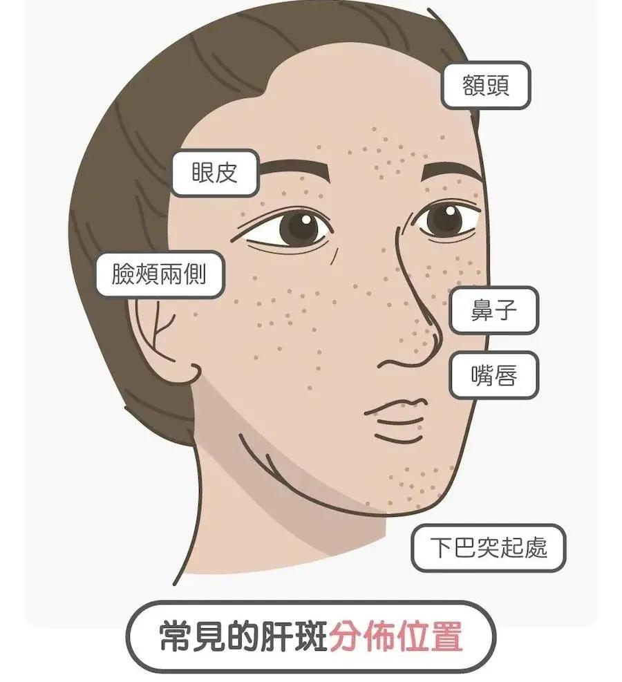 别踩雷了看看这些美妆雷区,淡斑美白踩雷