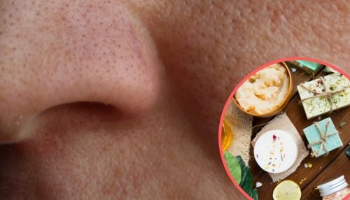 靠护肤品真能缩小毛孔吗,护肤品是怎么让毛孔缩小的