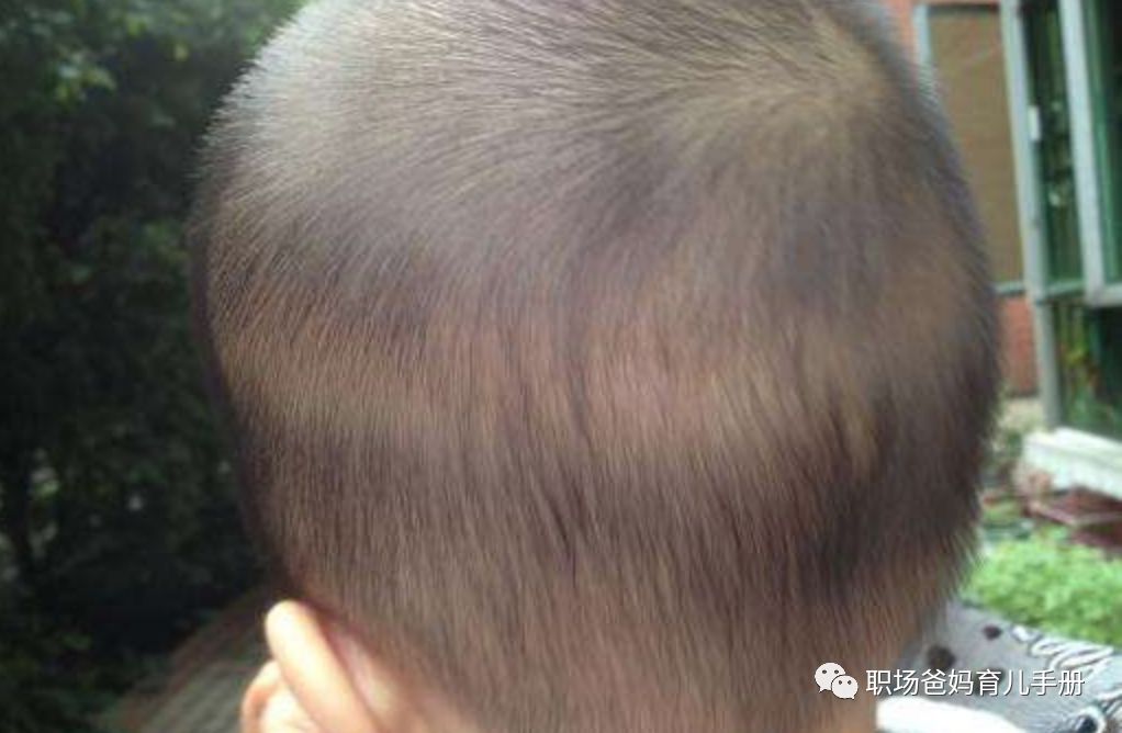 胎毛很好说明什么,胎毛意义