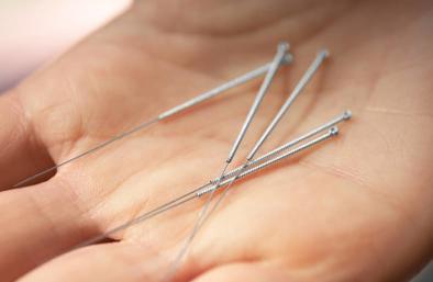 针灸对脑梗死的功效与作用,脑梗死中医辨证针灸治疗