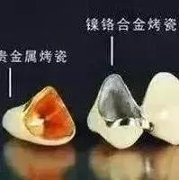 钴铬合金烤瓷牙和全瓷牙的区别,烤瓷牙和全瓷牙的区别在哪里