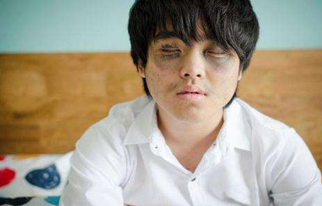 罗志祥眼袋是黑眼圈吗,罗志祥有黑眼圈和没有黑眼圈对比