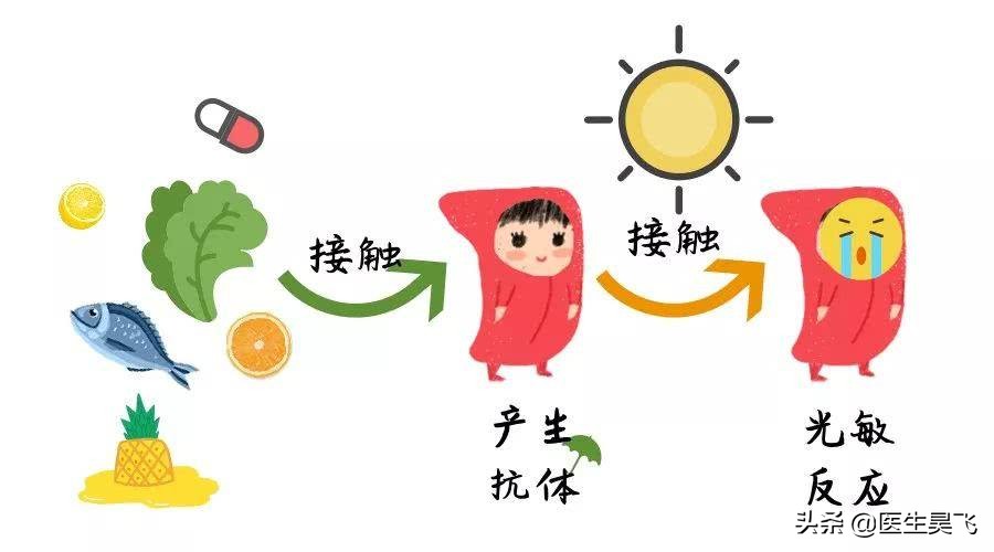 光过敏春季,阳光过敏原因