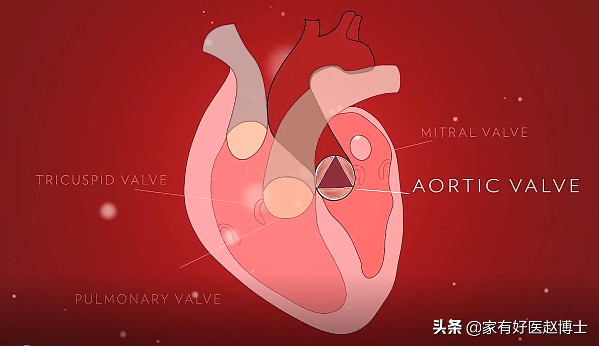 脂蛋白a升高有药治吗,脂蛋白a升高原因