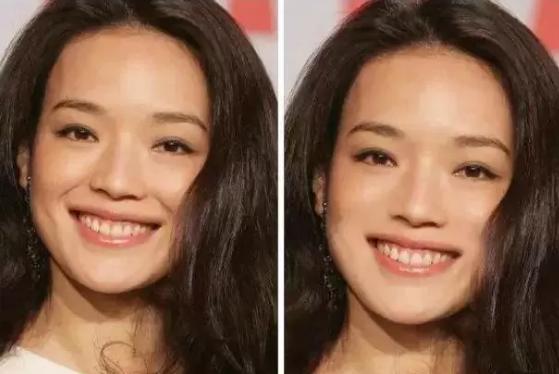 杨紫法令纹和嘴角纹怎么这么深,杨紫法令纹断层好吗