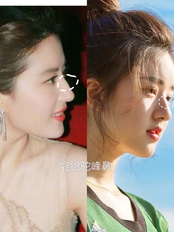 如何分辨鼻子整没整过,如何辨别鼻子有没有整过