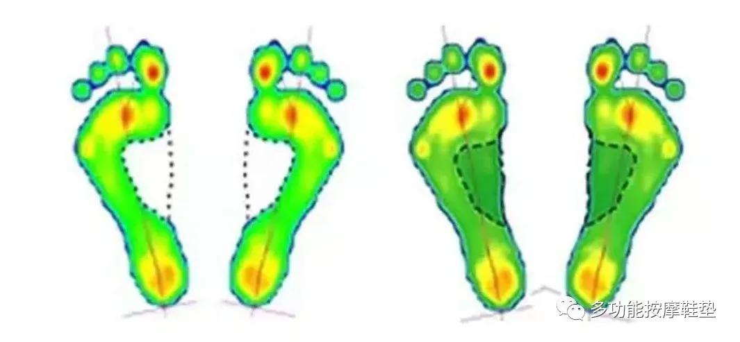 带按摩功能的鞋垫,多功能按摩鞋垫