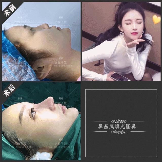 814元人气精华护理免费做！一次就焕颜新生！聚会女王就是你