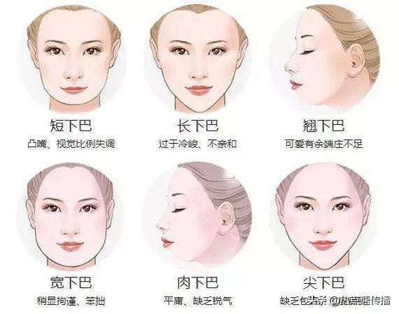 导致下巴歪的原因有哪些,下巴后缩严重的案例