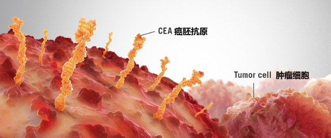 癌症病人癌胚抗原升高说明什么,癌胚抗原升高就是癌症吗