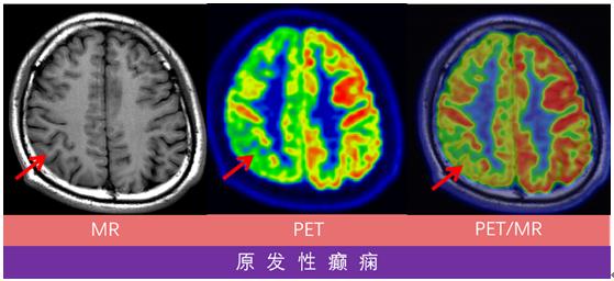 哈医大一院磁共振有片吗,哈医大一院能做内耳磁共振吗
