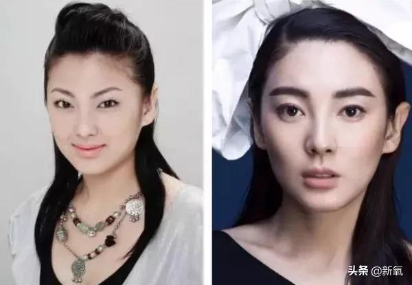 做双眼皮的姐妹还是要慎重,姐妹们你们割双眼皮多少钱