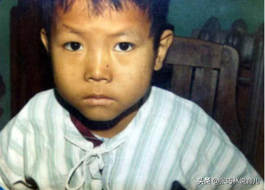 宝宝就脸黄身上都不黄问题大吗,宝宝皮肤黑黄是不是脾胃虚