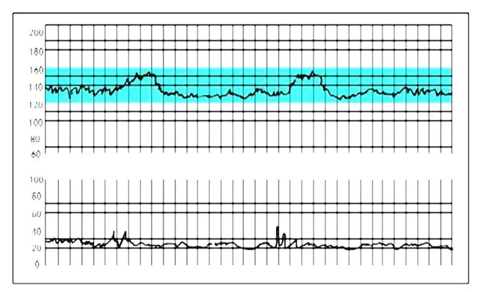 孕早期胎心率一般是多少到多少,看胎心率辨别胎儿有科学依据吗