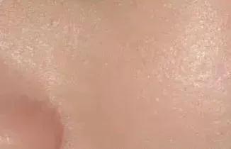 听说你毛孔大到可以放芝麻，该怎么办？