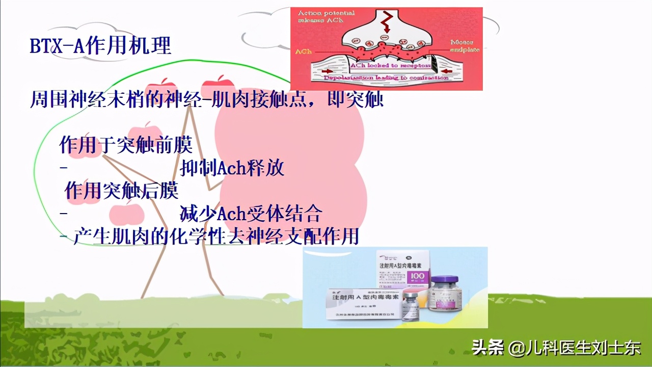 肉毒素治疗脑瘫患儿成功案例,肉毒素治疗脑瘫肌肉痉挛的效果