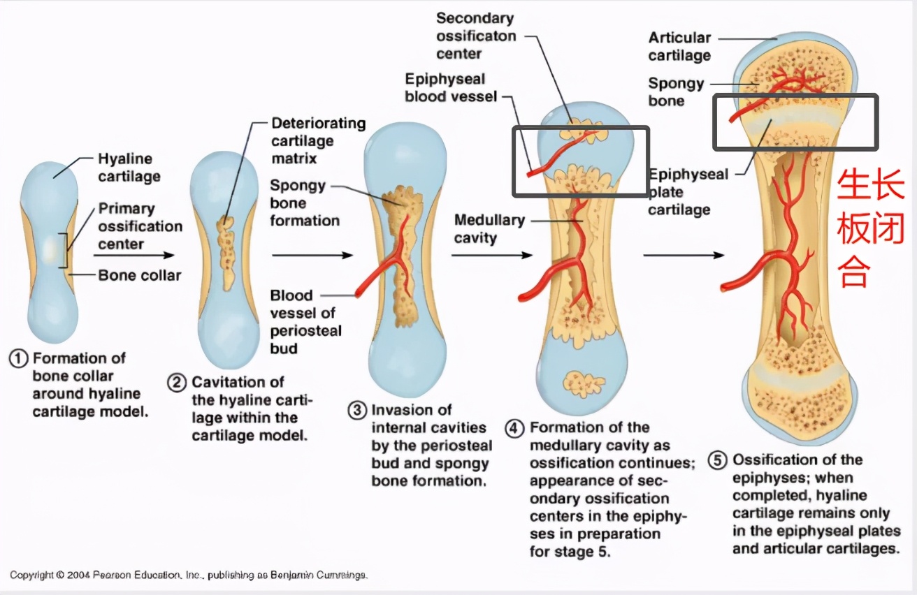 宝宝骨龄测算小了一岁,宝宝测骨龄有什么危害