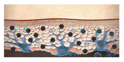 脖子发黑可能是2种癌症征兆,脖子下面一片红色警惕什么病