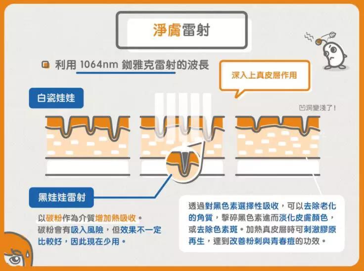 激光去青褐斑几次有效果,激光治疗斑点有效吗