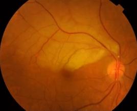 艺考生整容注意事项,艺考整形最佳方案